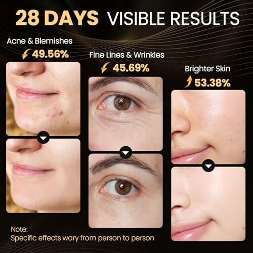 Image showing before and after results for acne, wrinkles, and brighter skin over 28 days.