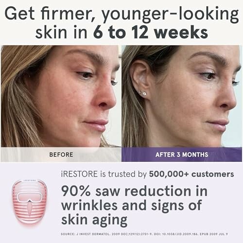 Before and after skin care results showing reduced wrinkles.
